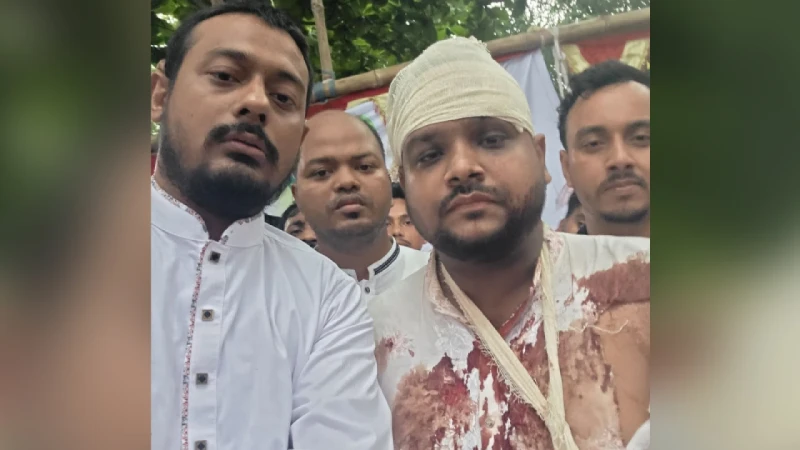 রক্তাক্ত ছবি শেয়ার করে স্বরাষ্ট্রমন্ত্রীর কাছে বিচার চাইলেন পাটওয়ারী