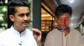 আলিফের একটা চোখের দৃষ্টি টোটালি শেষ: সারজিস