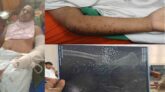 জুলাই আন্দোলনে গুলিবিদ্ধ বাগেরহাটের সন্তান আমিনুল ইসলামের বেঁচে ফেরার গল্প