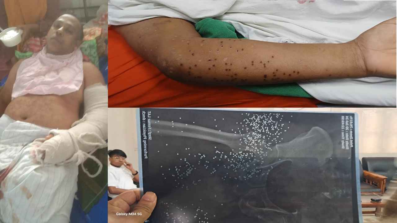 জুলাই আন্দোলনে গুলিবিদ্ধ বাগেরহাটের সন্তান আমিনুল ইসলামের বেঁচে ফেরার গল্প